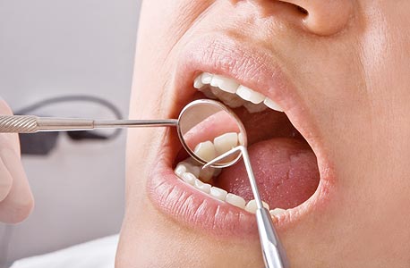 רופאת השיניים היתה צריכה לחשוב פעמיים לפני שפתחה את הפה, צילום: shutterstock
