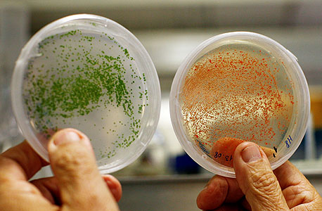 צלחות פטרי עם מיקרו־אצות במעבדה בשדה בוקר. "זה מדעי החיים, לא תהליך כימי. כל יום אתה מקבל משהו חדש" , צילום: צפריר אביוב