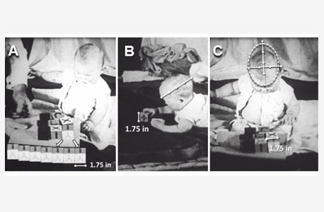 מתוך המחקר של פרופ' בק: מדידות ראשו של התינוק אלברט, לפי תמונות מהסרט. בק סבור שאמו הסכימה לניסויים כדי שבית החולים יטפל בו