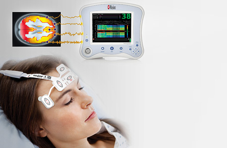 EEG. אלקטרודות למוח, צילום: אי פי איי
