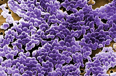 הגדלת מיקרוסקופ של החיידק העמיד אנטרוקוקוס. כ-18 זנים נמצאים במעקב, צילום: ג