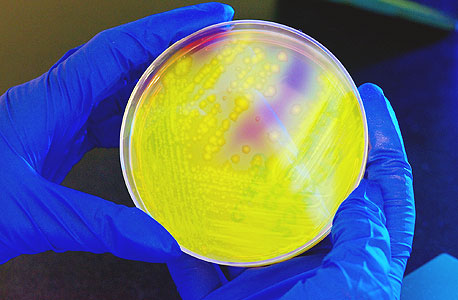 תרבית של קלוסטרידיום דיפיציל, חיידק מעיים שגורם לשלשולים דווקא במהלך טיפול באנטיביוטיקה, צילום: באדיבות CDC
