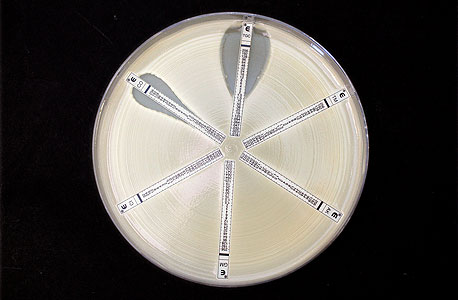 תרבית של החיידק העמיד קלבסיאלה, שפייזר מצאה לו אנטיביוטיקה חדשה ב-2005. ב-2012 פייזר סגרה את מחלקת האנטיביוטיקה שלה, צילום: רויטרס