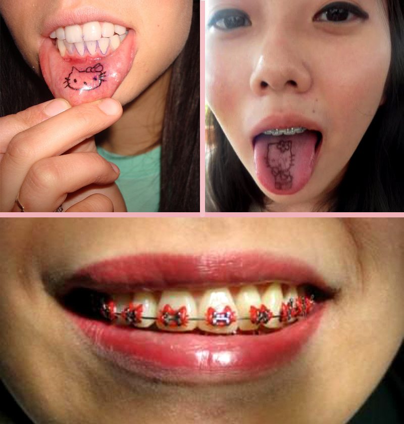 קיטי נכנסת לכם לפה עם קעקועים ויישור שיניים קיטי נכנסת לכם לפה עם קעקועים ויישור שיניים