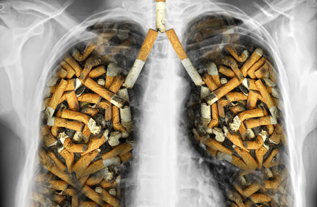 נזקי העישון לריאות, צילום: שאטרסטוק