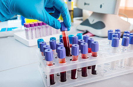 Blood test (illustration). Photo: Shutterstock Blood test (illustration). Photo: Shutterstock