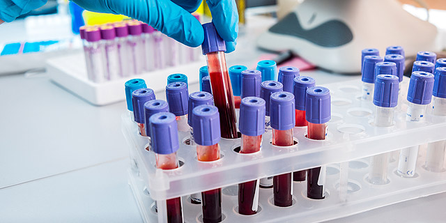 Blood Testing Startup Sight Raises &#036;28 Million