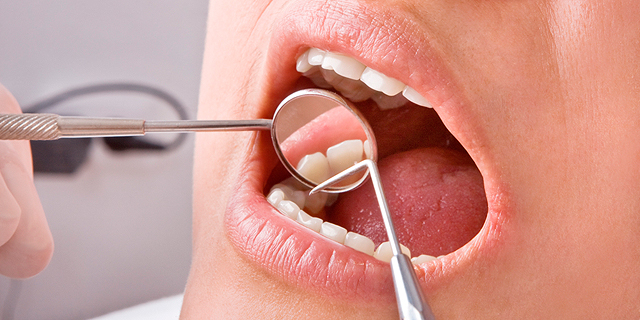 קולגייט מזמינה את הציבור לבדיקת שיניים בחינם