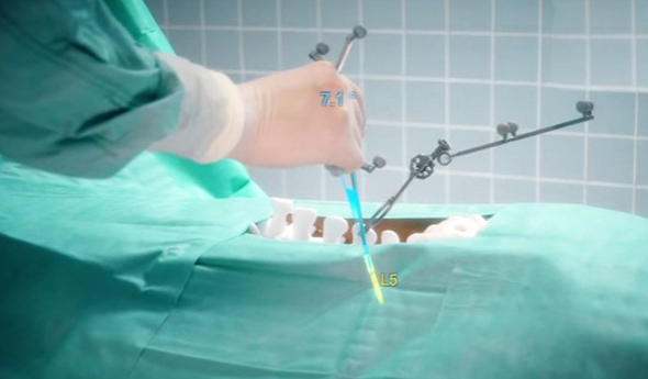 מיקרוסופט הולולנס מציאות מוגברת ניתוח, צילום: youtube