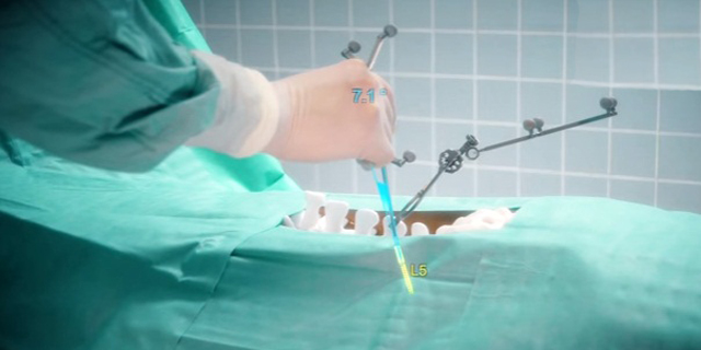 המנתח הביוני: כך מסייעים משקפי מיקרוסופט לכירורגים