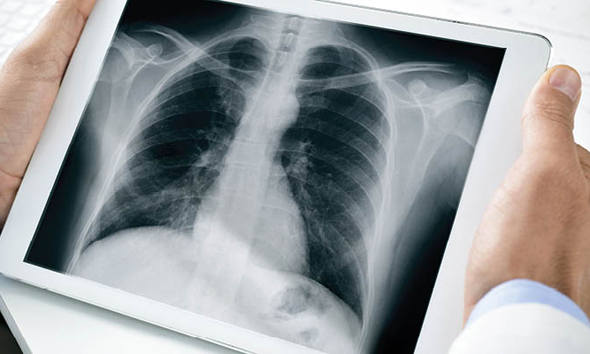  A doctor examining a chest x-ray. Photo: Shutterstock
