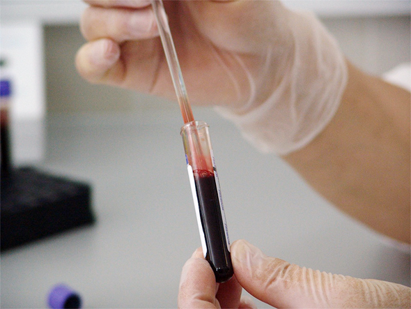 בדיקת דם לגילוי מוקדם של סרטן   , צילום: PublicDomainPictures/Pixabay