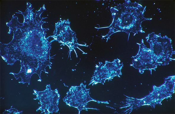 תאים סרטניים, צילום: skeeze/Pixabay