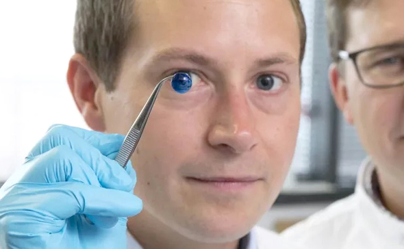 A technician holds up a 3D printed cornea. Photo: Newcastle University