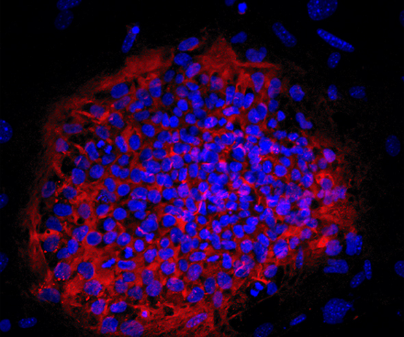 A colony of haploid human embryonic stem cells. Photo: NewStem