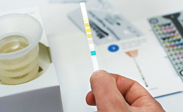 Healthy.io's urinalysis kit. Photo: PR Healthy.io's urinalysis kit. Photo: PR