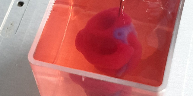 Israeli Researchers 3D Print a Mini Working Heart from Human Tissue
