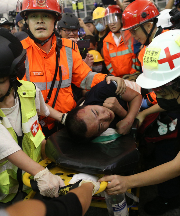 פצוע מפונה לקבלת טיפול רפואי בהונג קונג, לאחר שהוחזק על ידי המפגינים, צילום: אי פי איי