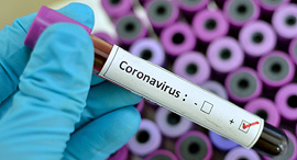 Coronavirus blood test (illustartion). Photo: getty Images