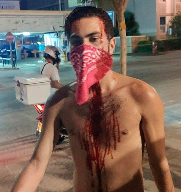 מפגין פצוע בתל אביב, צילום: בן נצר גלי צה"ל