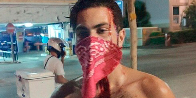 צפו בתיעוד: פעילי ימין תקפו ופצעו הלילה מפגינים בתל אביב