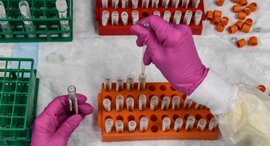 Testing in lab. Photo: AFP