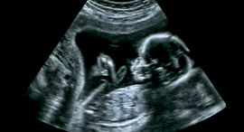 How is a managing a startup similar to waiting for a baby to be born?. Photo: Shutterstock