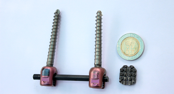 The company's zLOCK device next to an Israeli shekel coin for size-comparison. Photo: ZygoFix