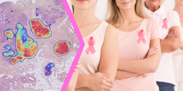 Ibex obtains CE Mark for AI-powered breast cancer detection