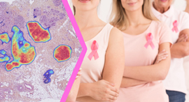 It has already been ordered by a number of labs in Europe. Photo: Ibex Medical Analytics