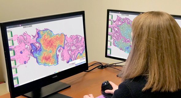 A lab technician assesses a pathology report using the technology. Photo: Ibex Medical Analytics