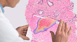 Diagnostics. Photo: Ibex Medical Analytics