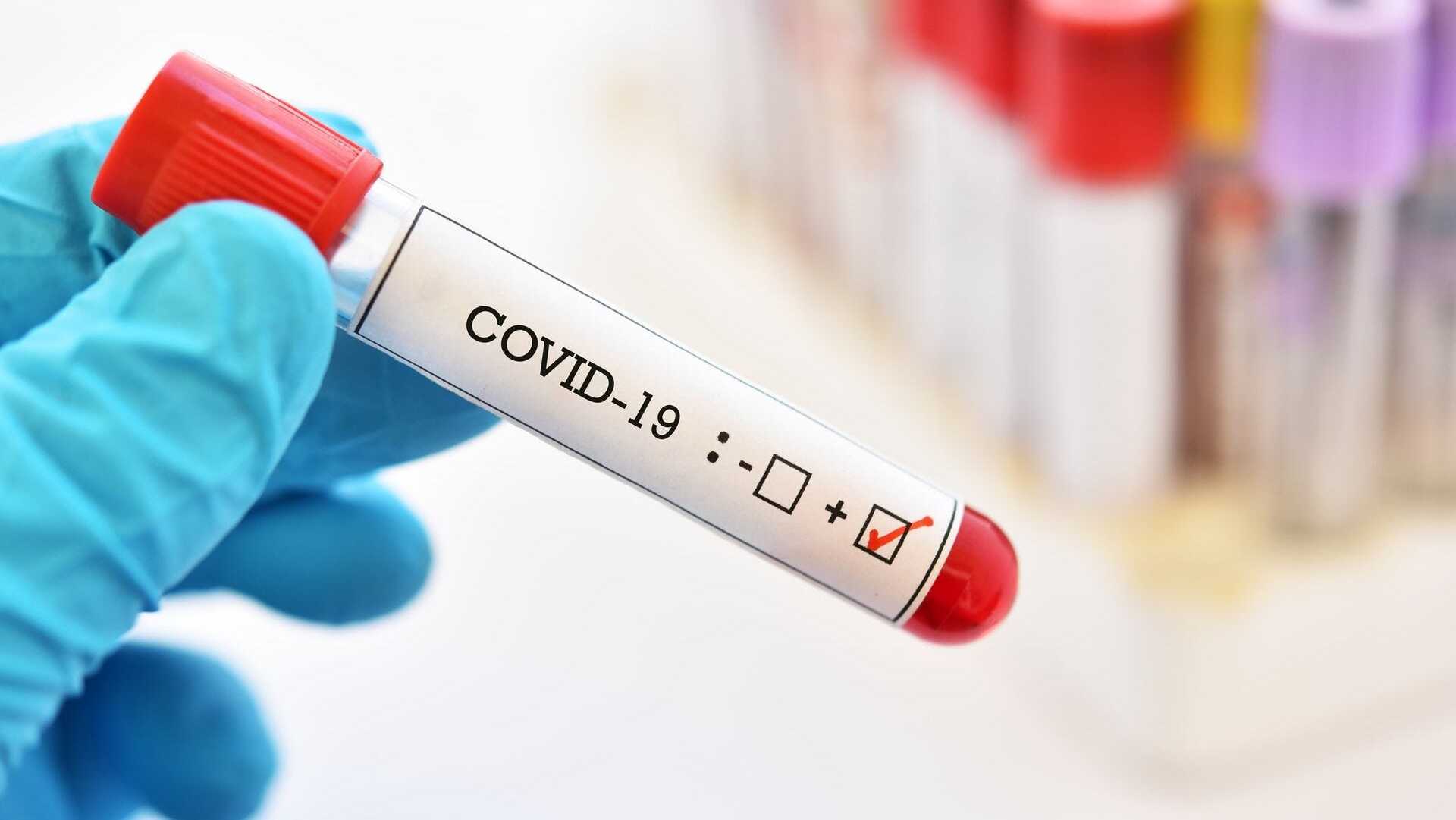 בדיקה בדיקת קורונה קוביד-19 וירוס 