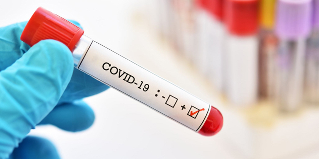 בדיקה בדיקת קורונה קוביד-19 וירוס 