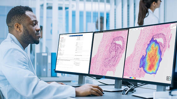 Ibex Medical Analytics