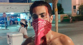 מפגין תל אביב נפצע הפגנה