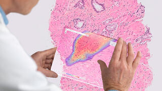 אייבקס אנליטיקס ibex analytics