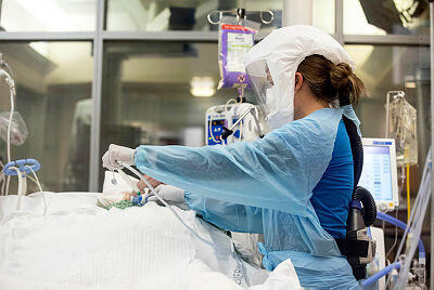 חולה קורונה בבית חולים בסן דייגו קליפורניה, צילום: EPA