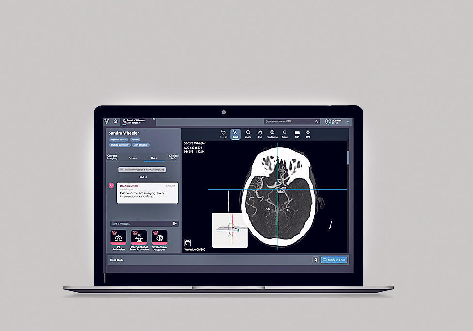 מערכת  סריקות CT של viz.ai