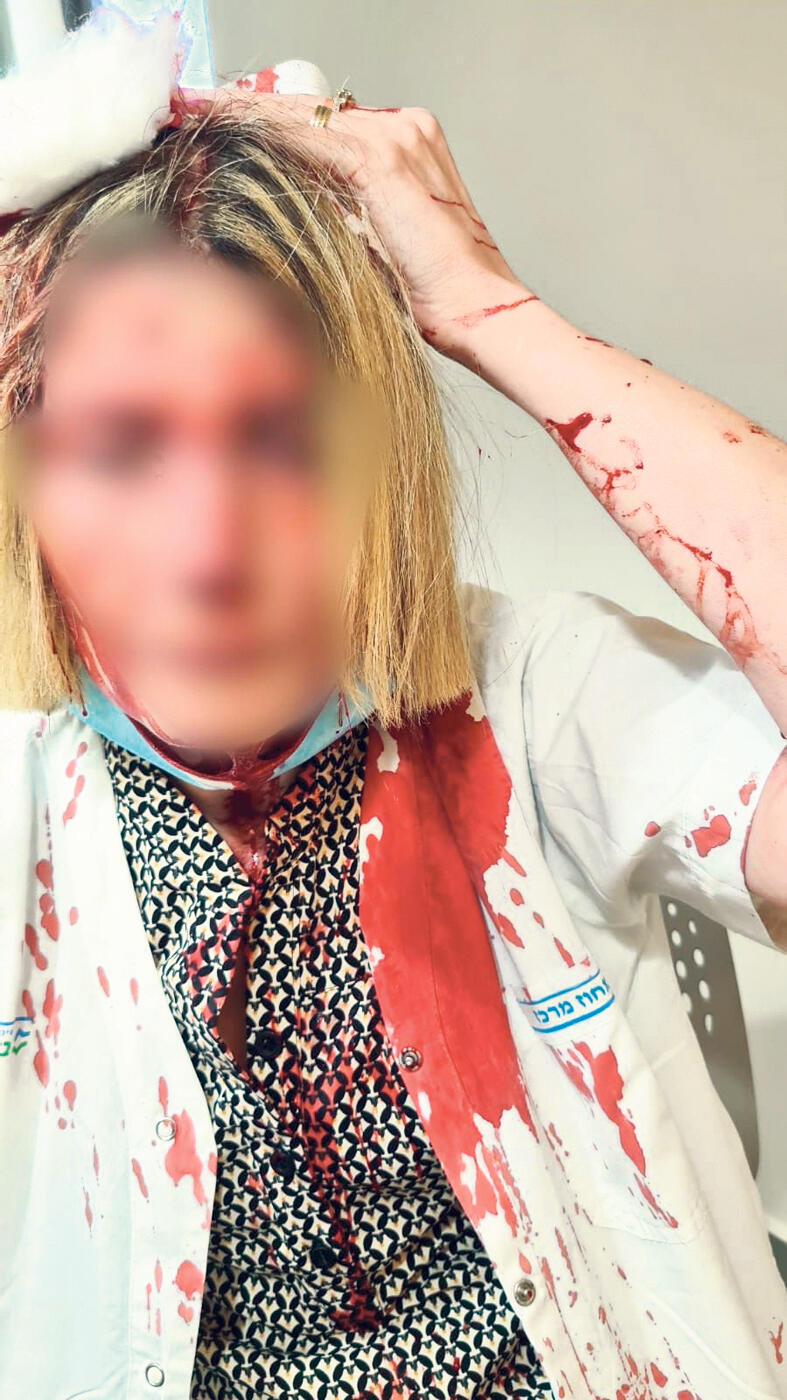 רופאה מדממת במרפאה בבאר יעקב לאחר שהותקפה על ידי מטופל