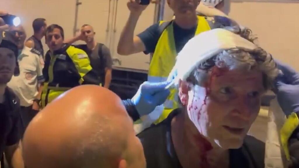 גדי קדם לאחר שהותקף בראשו במהלך הפגנת המחאה בתל אביב