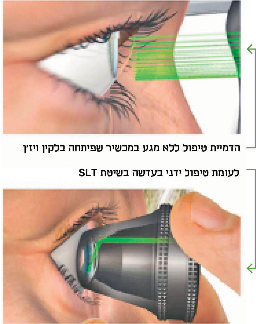 הדמיית בדיקת ראיה בלקין