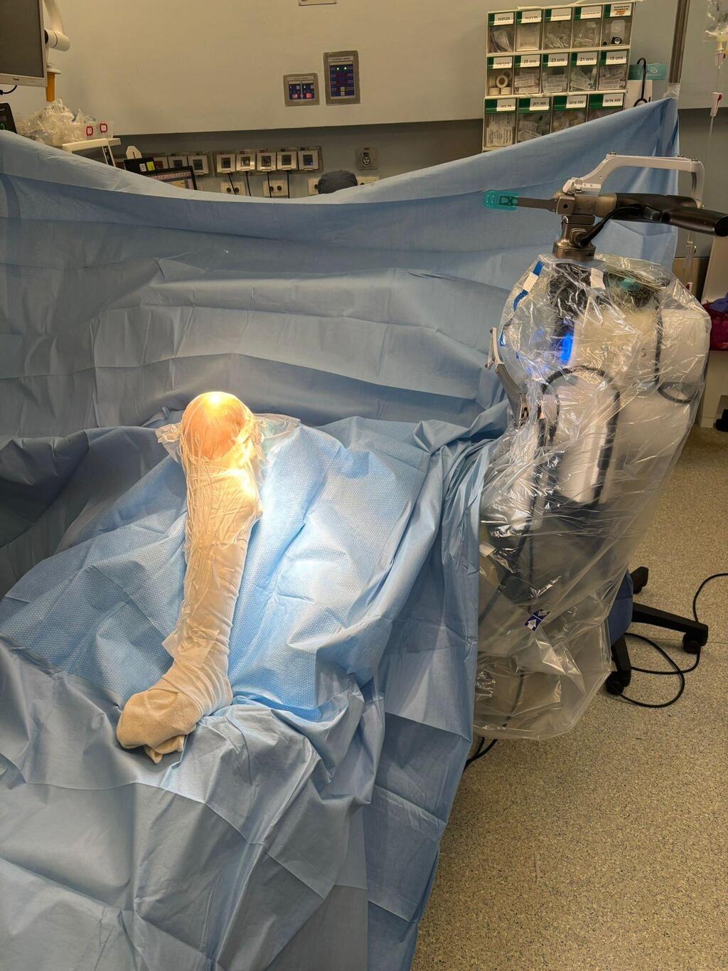 הברך המנותחת עם הרובוט לצידה בתחילת הניתוח (צילום: באדיבות ד"ר נביל גרייב) הברך המנותחת עם הרובוט לצידה בתחילת הניתוח