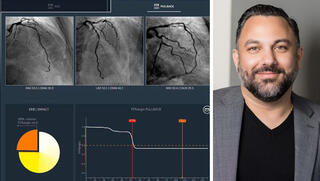 מנכ"ל קתוורקס רמין מוסאבי והמערכת של החברה