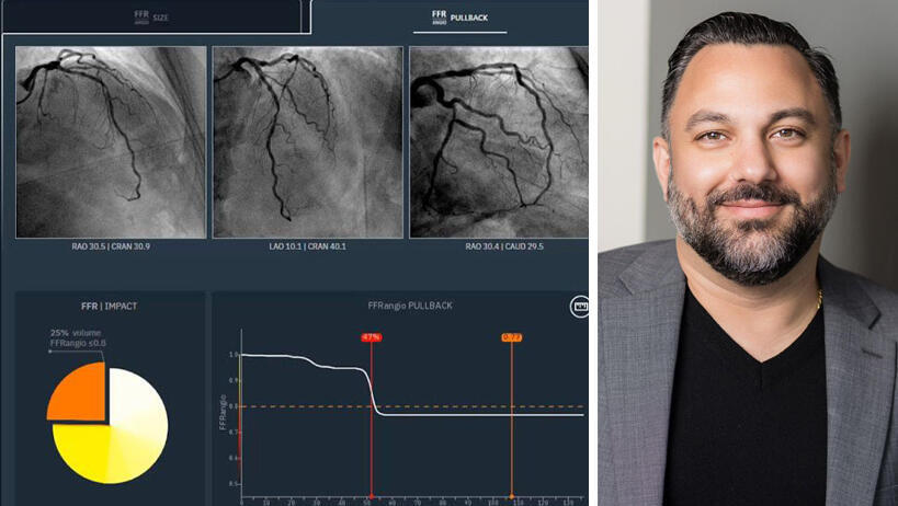 מנכ"ל קתוורקס רמין מוסאבי והמערכת של החברה