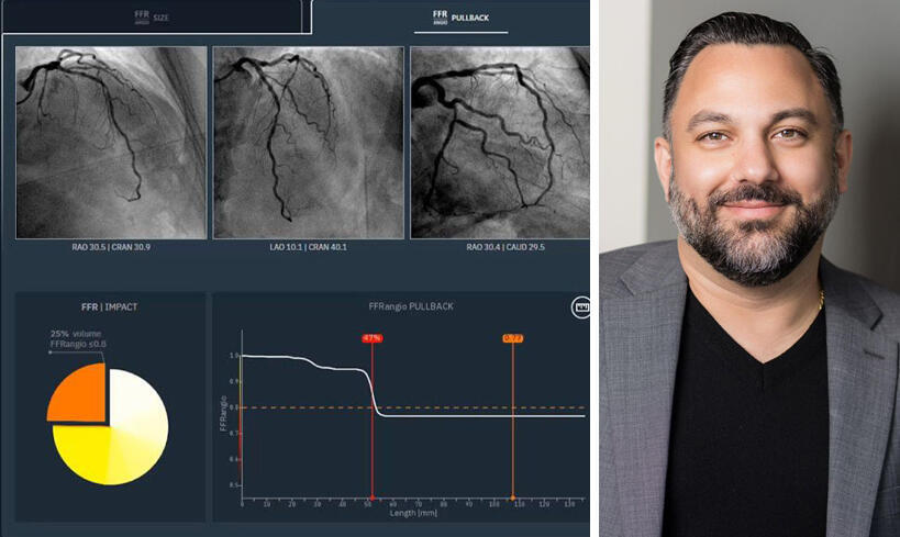 מנכ"ל קתוורקס רמין מוסאבי והמערכת של החברה