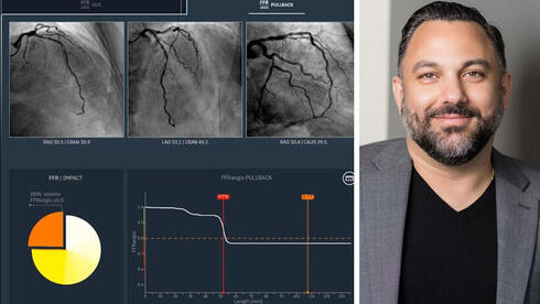 אקזיט מכל הלב: החברה הישראלית שבראשה עומד איראני נמכרת במאות מיליונים | כלכליסט