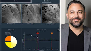 מנכ"ל קתוורקס רמין מוסאבי והמערכת של החברה