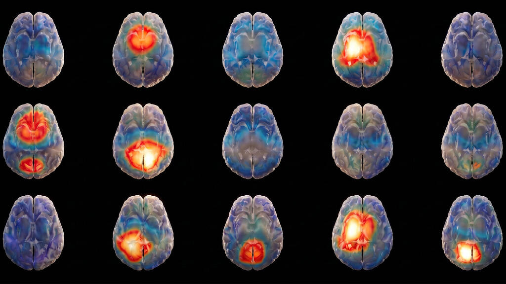 brain grid Hemispheric