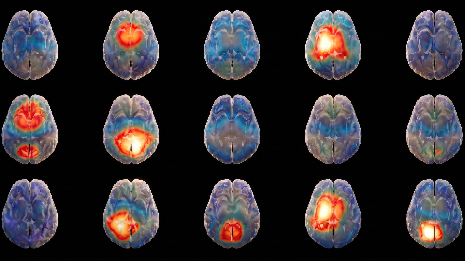 brain grid Hemispheric